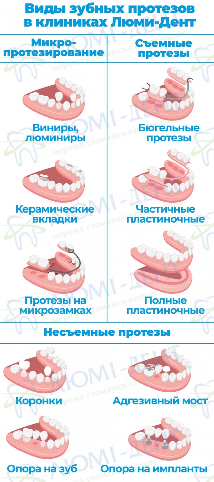 Протезирование зубов протезы фото Люми-Дент