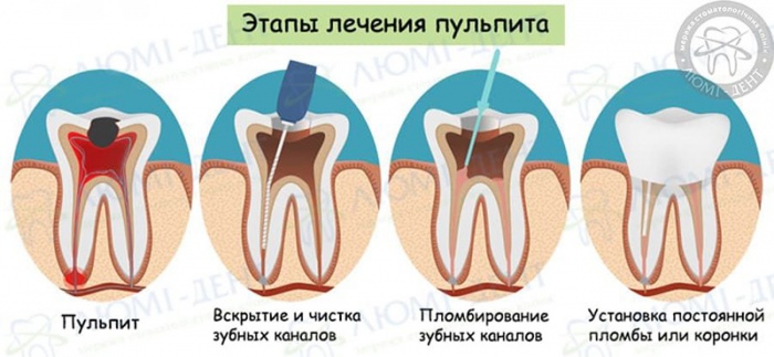 Стоматологическое лечение зубов фото Люми-Дент