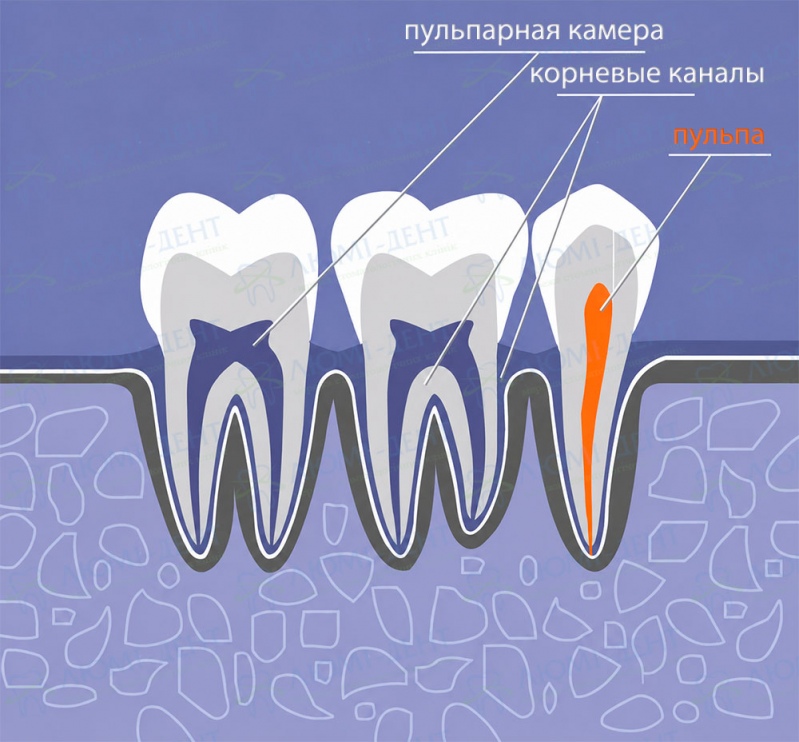 строение зуба и расположение корневых каналов. строение зуба и расположение корневых каналов.