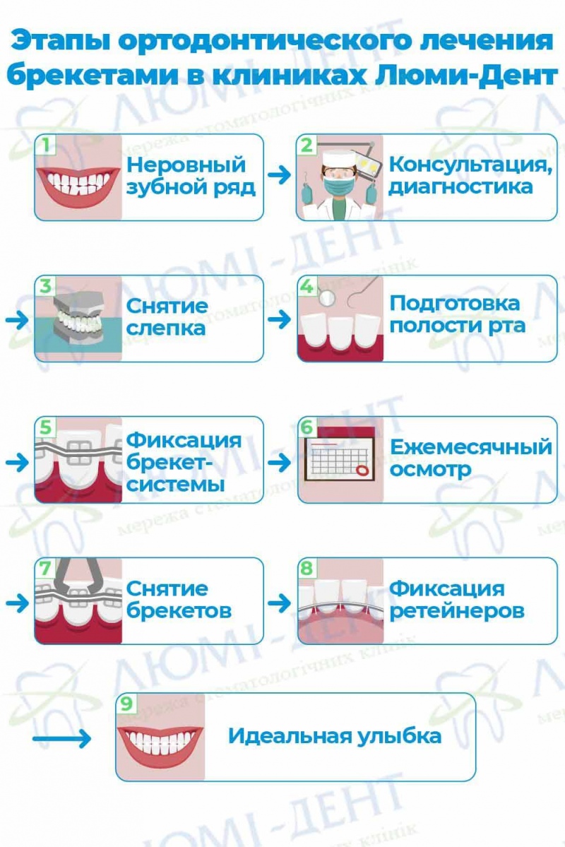 Этапы установки брекет систем Металлические брекеты Люми-Дент