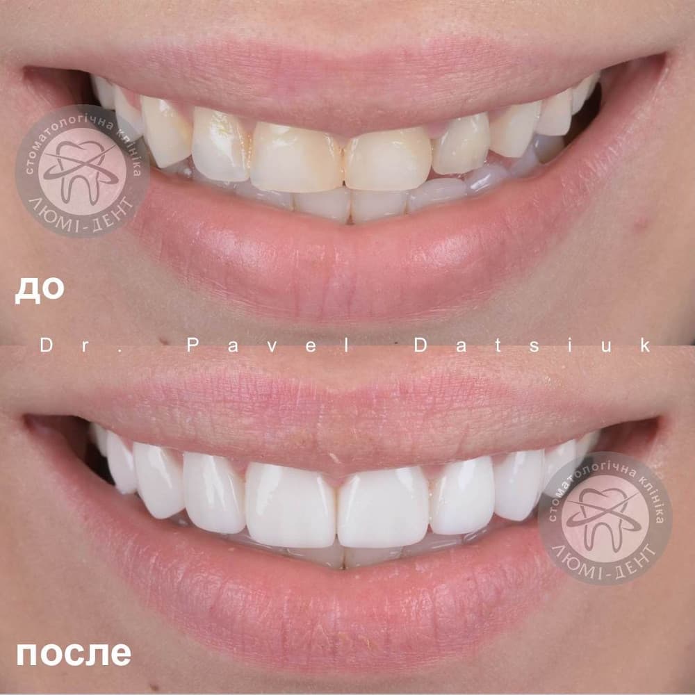 Dentist Kiev🦷Dental clinics LumiDent🦷Dentistry Ukraine