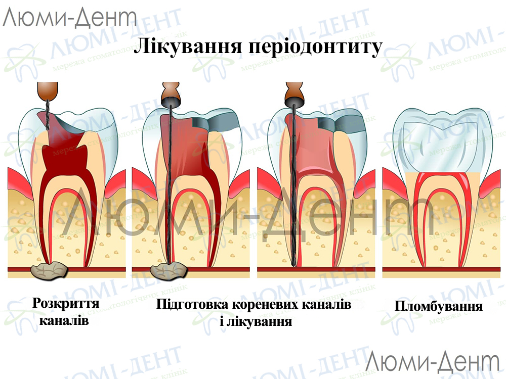 Заболел зуб картинки