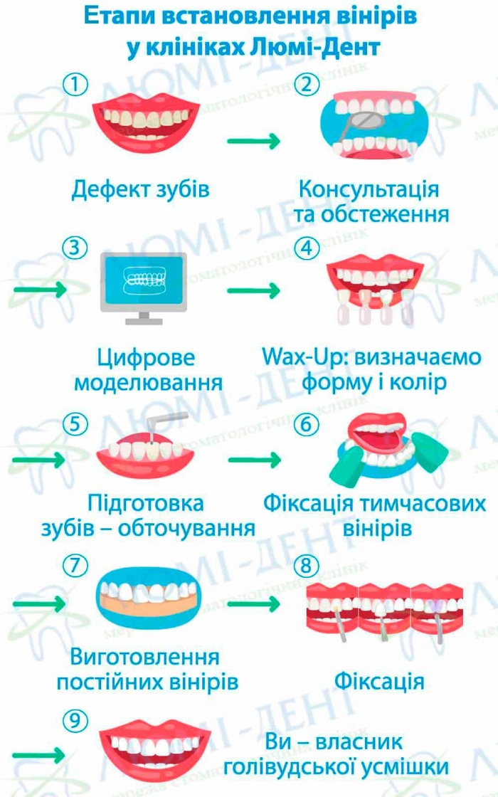 вініри на нижніх зубах фото Люмі-Дент