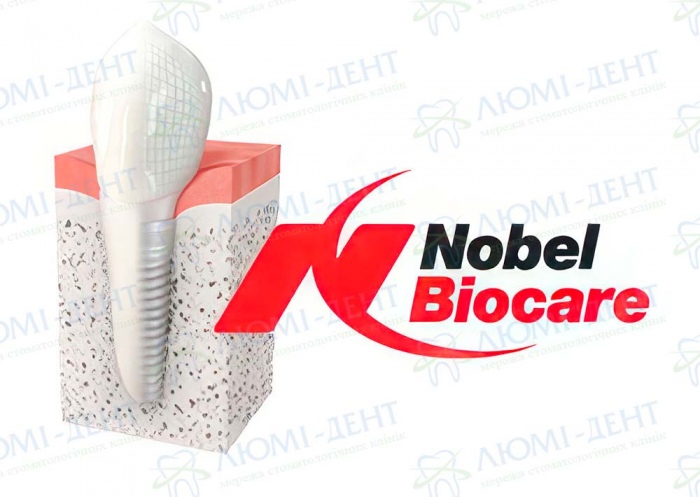 Акция на имплант Nobel Biocare фото Люми-Дент