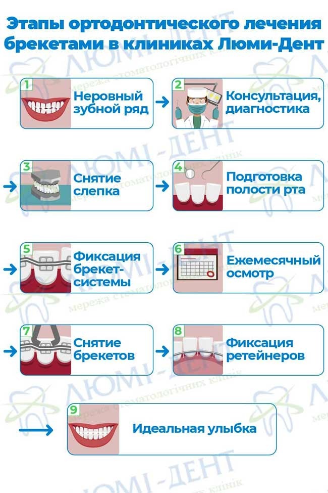 брекет система ormco фото ЛюмиДент