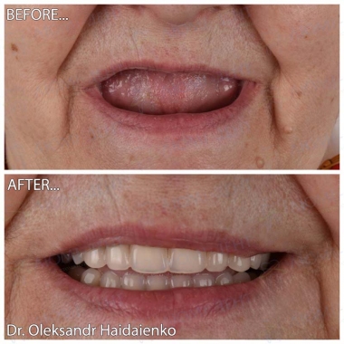 Dentistry «Lumi-Dent» in Kyiv Доктор ортопед Гайдаенко