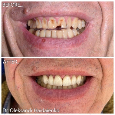 Dentistry «Lumi-Dent» in Kyiv Доктор ортопед Гайдаенко