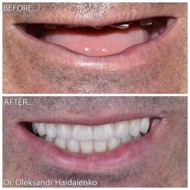 Dentistry «Lumi-Dent» in Kyiv Доктор ортопед Гайдаенко