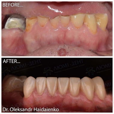 Dentistry «Lumi-Dent» in Kyiv Доктор ортопед Гайдаенко