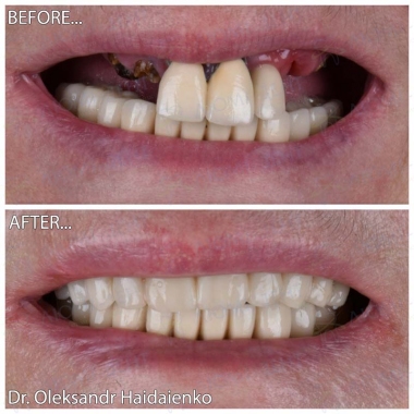 Dentistry «Lumi-Dent» in Kyiv Доктор ортопед Гайдаенко