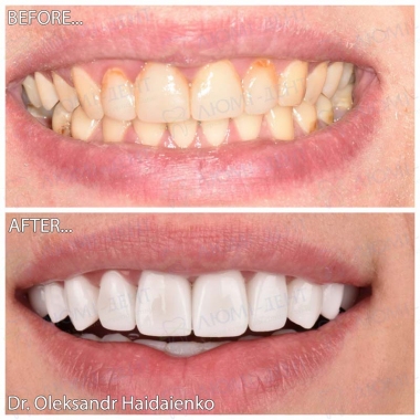Dentistry «Lumi-Dent» in Kyiv Доктор ортопед Гайдаенко